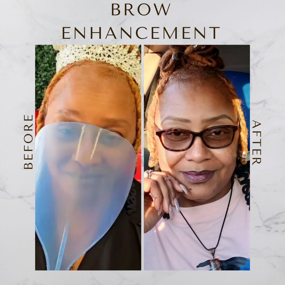 Eyebrow Enhancement
